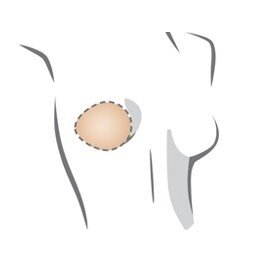 Balance Natura Thin Oval Breast Form 4